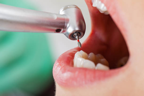 Best Emergency Cosmetic Dentistry (e.g., broken veneers) in West University Place, TX
